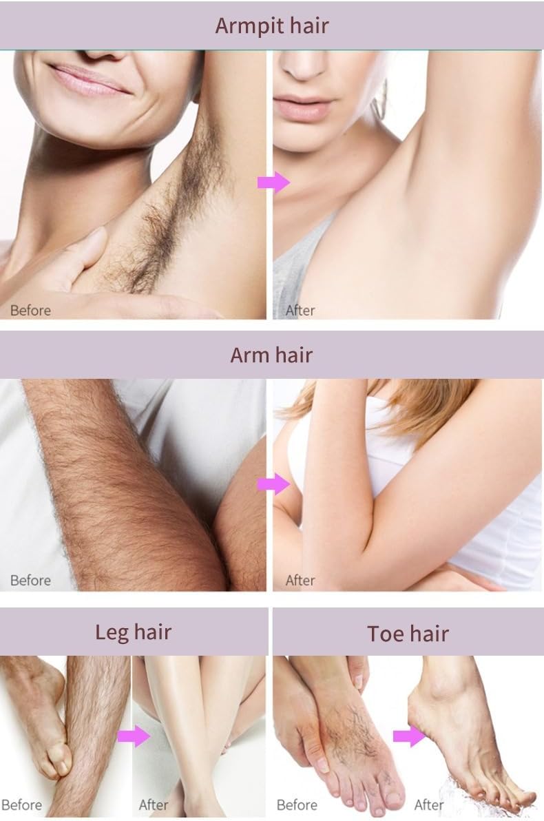 1pcs Natural Silky Beauty Spray Depilador, Fast-Acting Body Hair Remover for Underarms, Chest, Back, Health Hair Remover 150ml